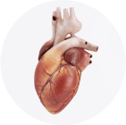 Myocardial infarction